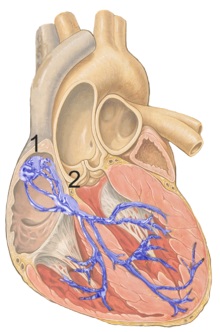 Cardiac pacemaker.jpg